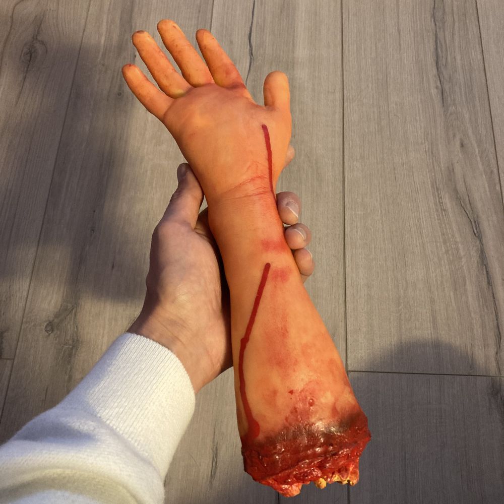 Avhuggen Arm