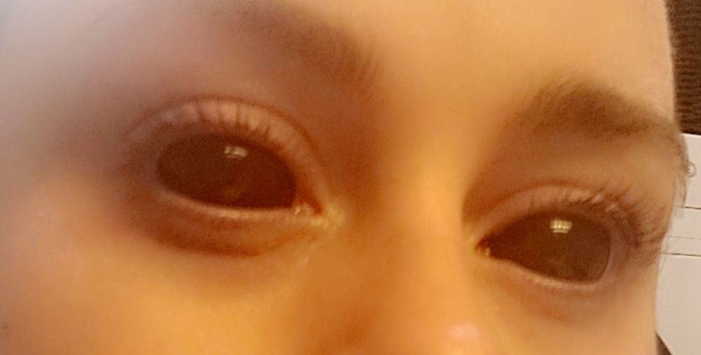 Sclera-linssit Sabretooth