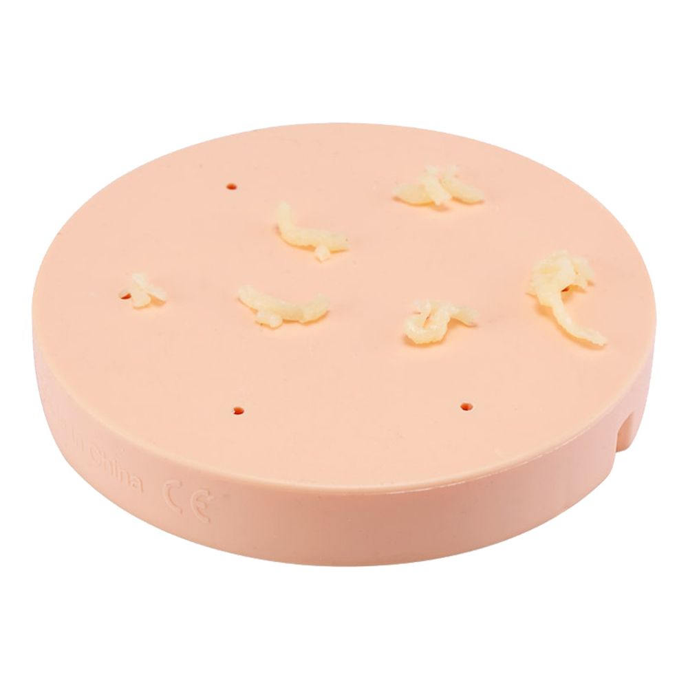 Zuru Pimple Popper